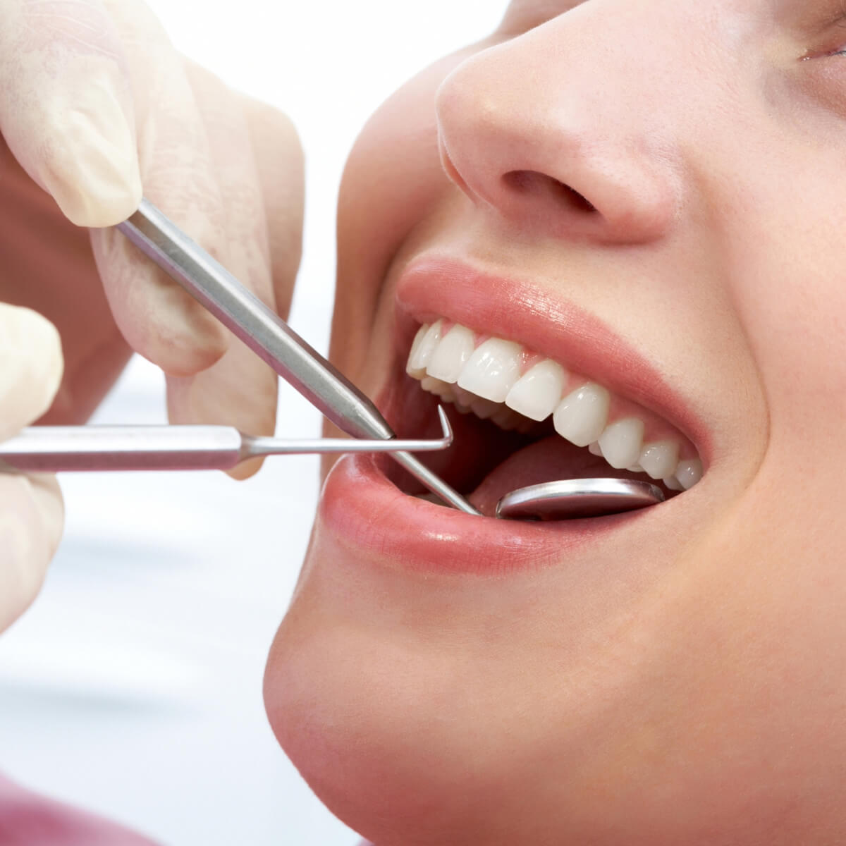 root canal retreatment in San Antonio TX area